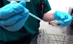 Bloodtest